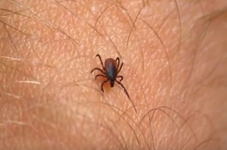 Closeup of blacklegged tick on a person's skin